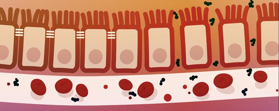 permeabilidad intestinal altercaion celulas